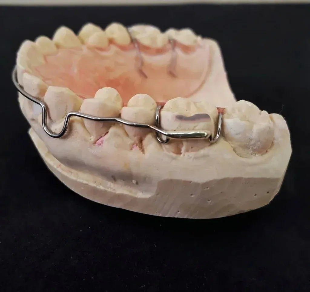 Hawley retainer, labial bow over an acrylic base, on the model