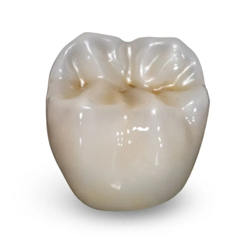 Milled PMMA provisional on the master model