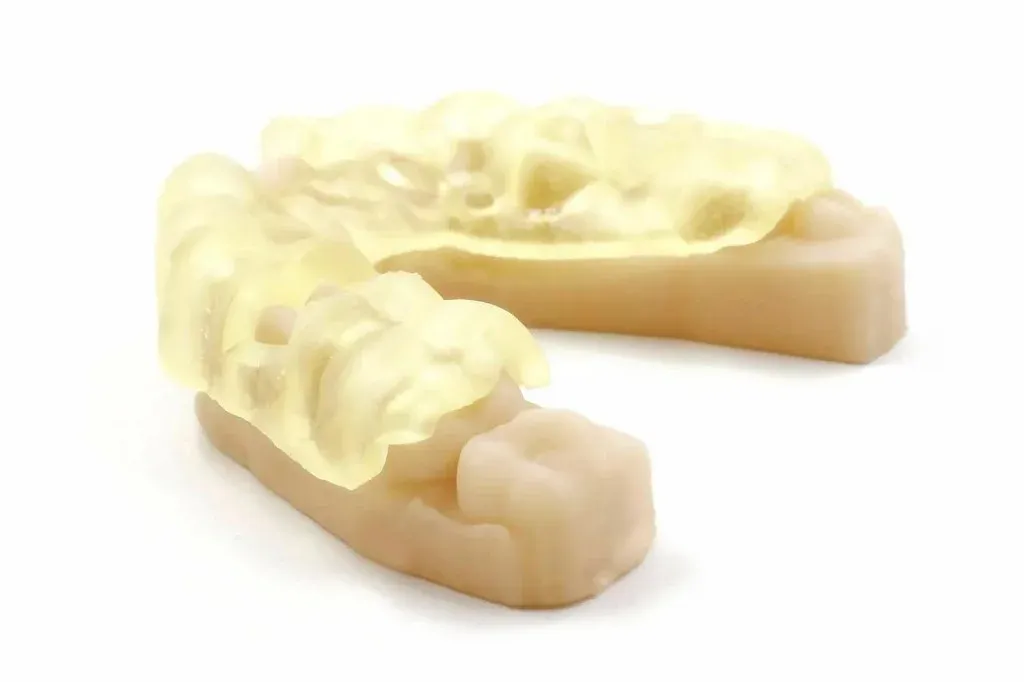 A bis-acryl temporary formed at the chair