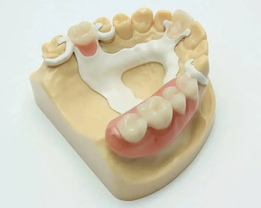 Acetal resin partial with tooth-colored clasps on the master model