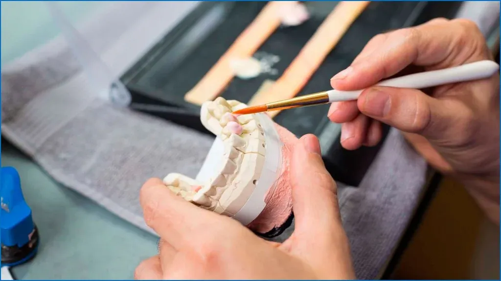Anterior veneer case on the model beside calibrated shade photography
