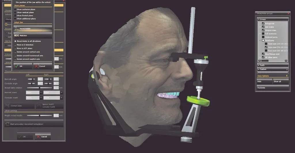 Technician and ceramist reviewing an articulated case and CBCT together on screen