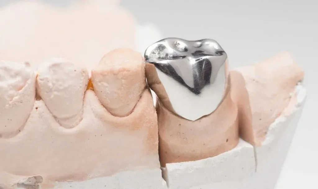 Cast base-metal crowns polished on the master model