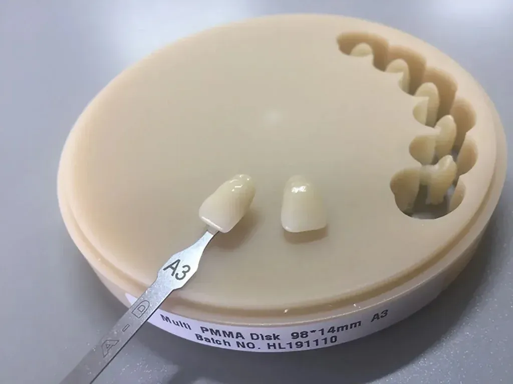Milled PMMA provisional crowns on the master model