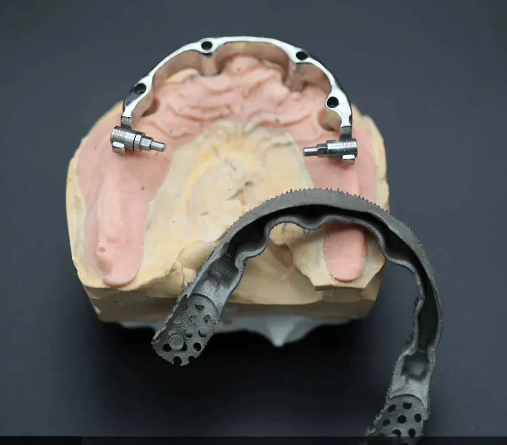 Milled titanium overdenture bar seated on the master model, attachment clips in place