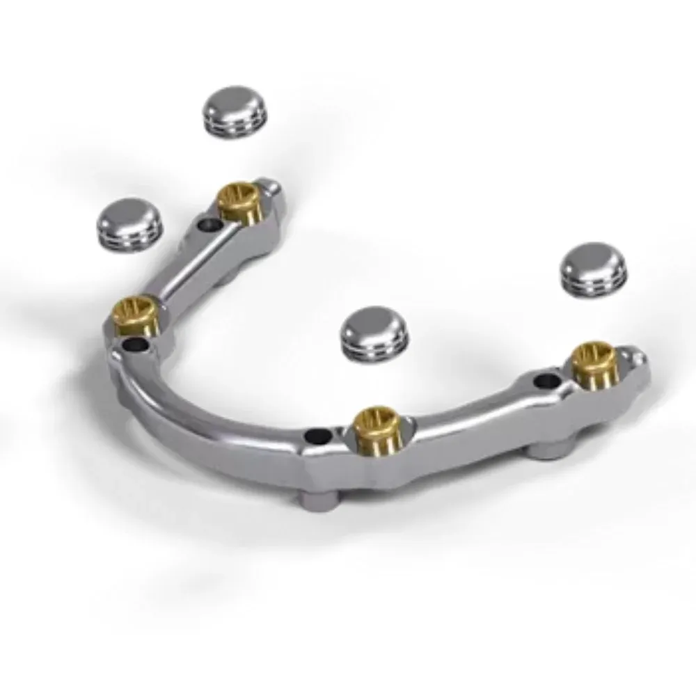 Screw-retained implant crown with the access channel visible