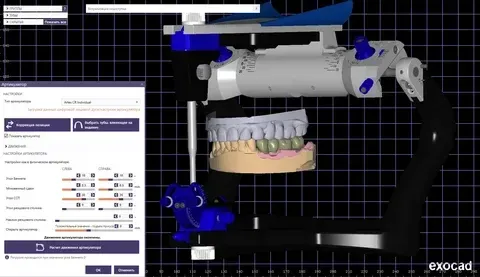 Technician designing a diagnostic digital wax-up for an anterior case.