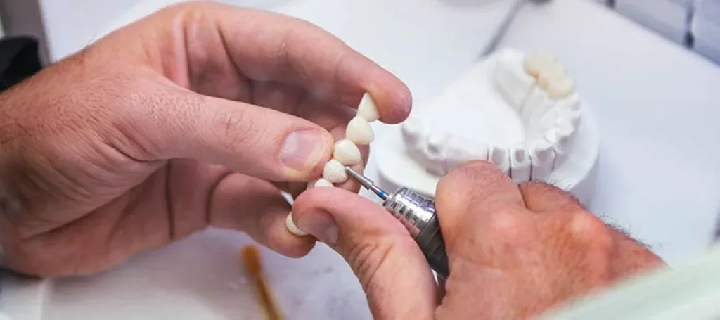 Technician marking a working-side occlusal contact on a seated crown with articulating paper