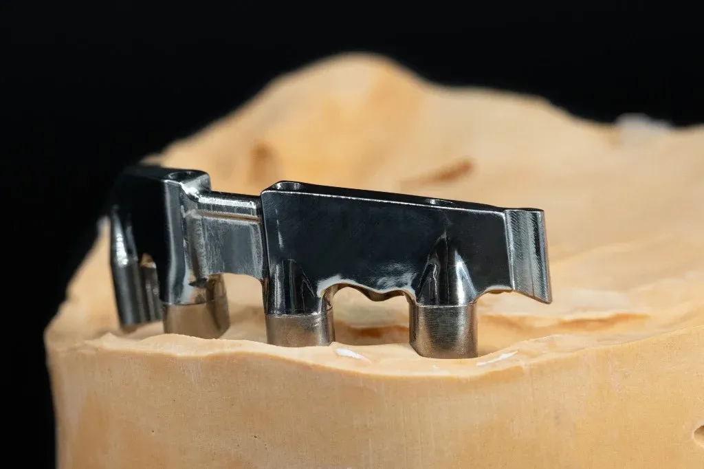 A bar screwed down on the master model, each connection checked for lift