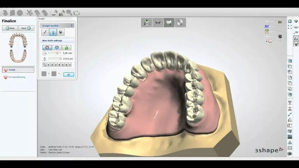 A CAD screen showing the denture designed against the scanned ridge
