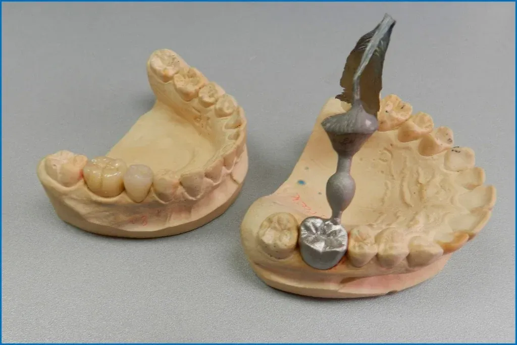 A castable pattern being invested for lost-wax gold casting