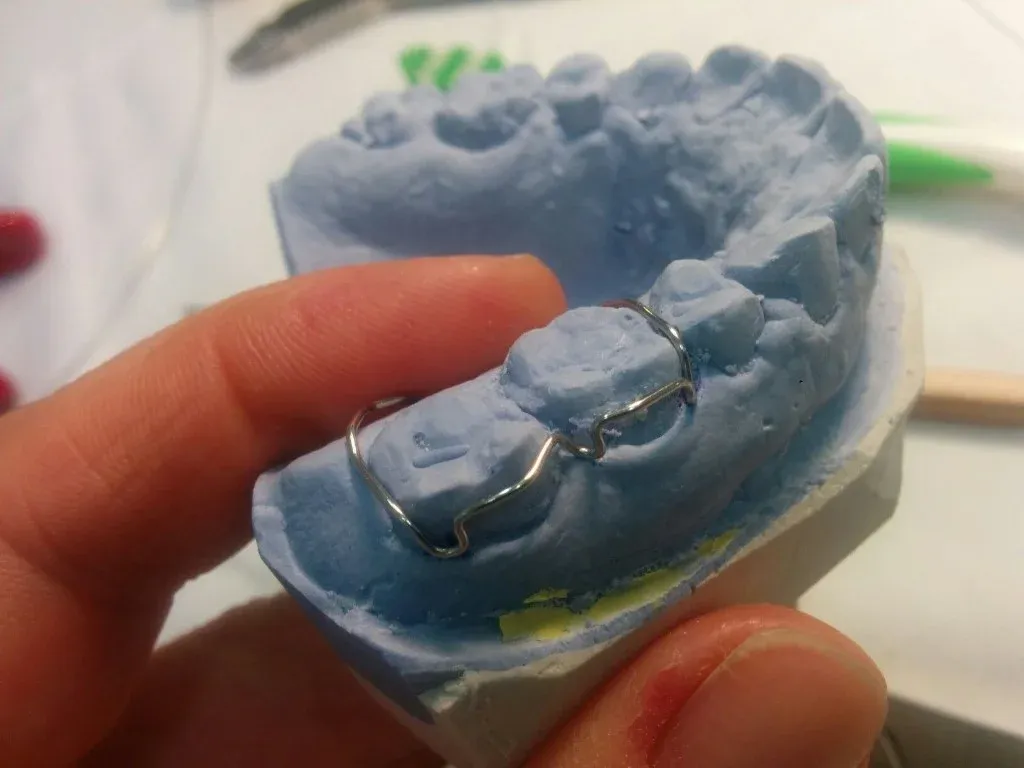 A technician adapting a stainless labial bow on the acrylic base