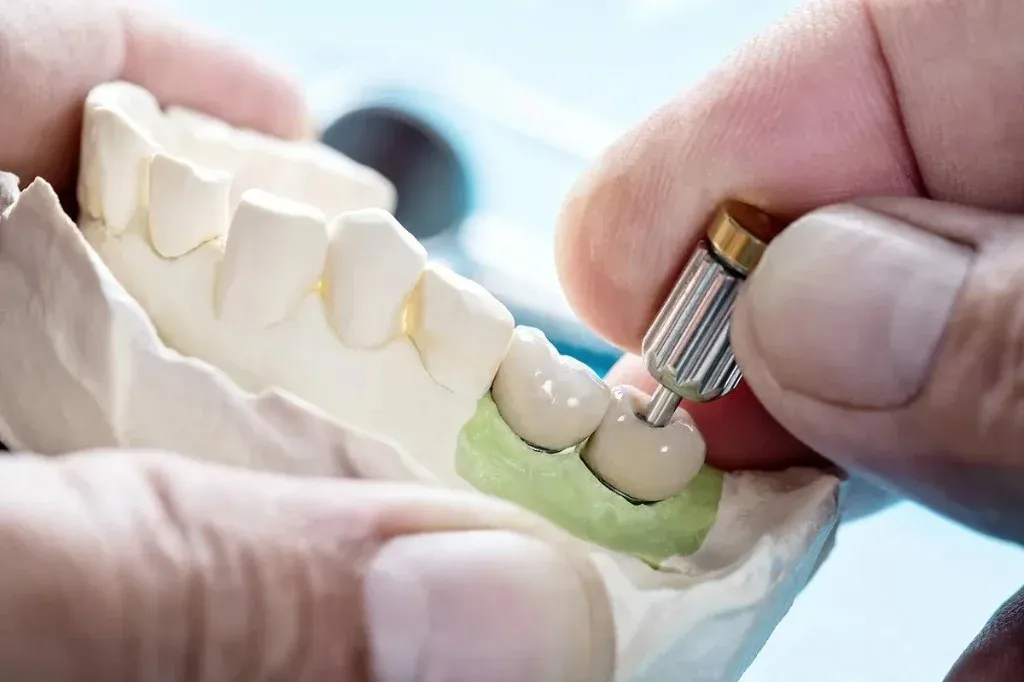A technician checking a screw-retained crown on the implant analog