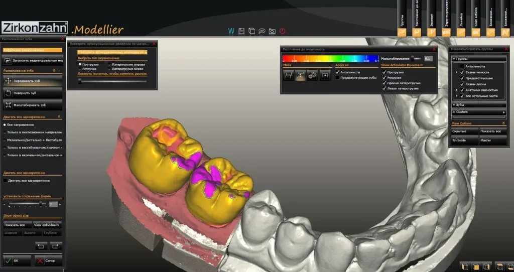 Digital restoration design open on screen beside the model, ready to rebuild from the file