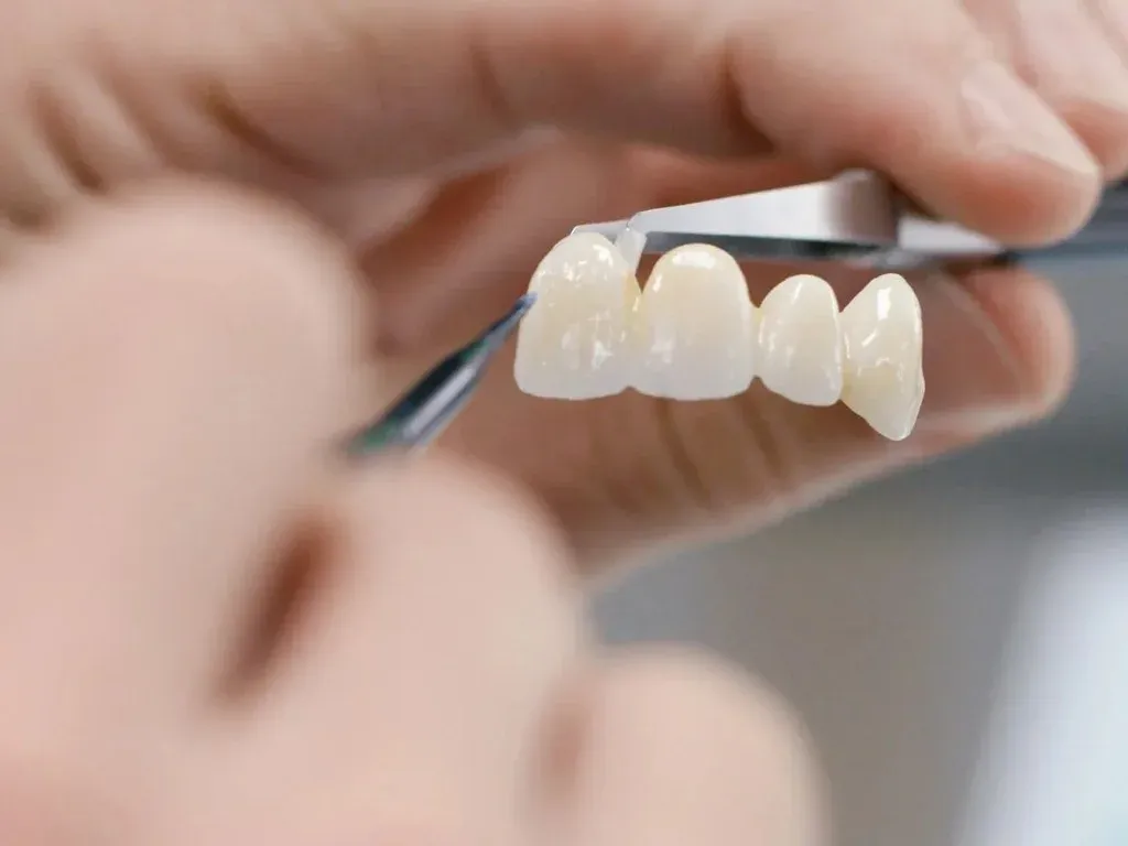 Ceramist comparing a layered anterior crown against shade photos under corrected lighting