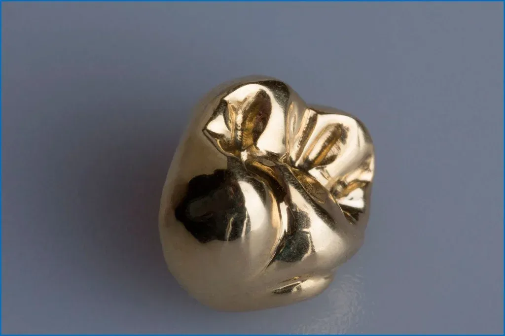 Full cast gold crown beside a CoCr framework, showing the alloy contrast