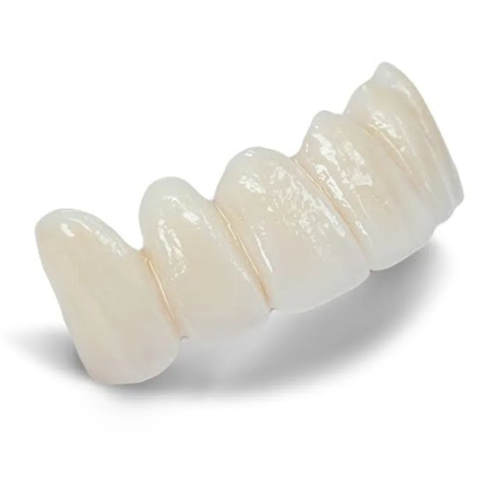 Monolithic zirconia dental bridge