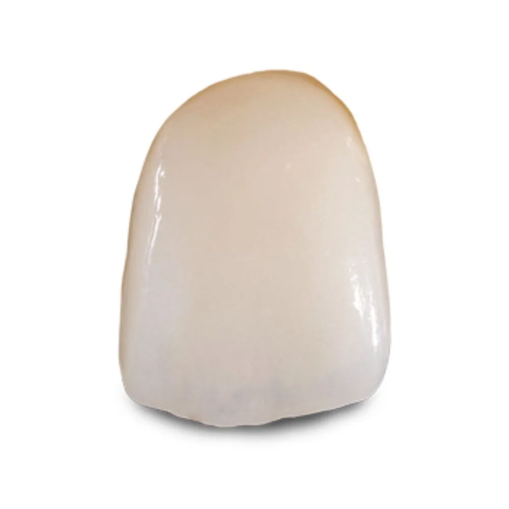 IPS e.max lithium-disilicate crown