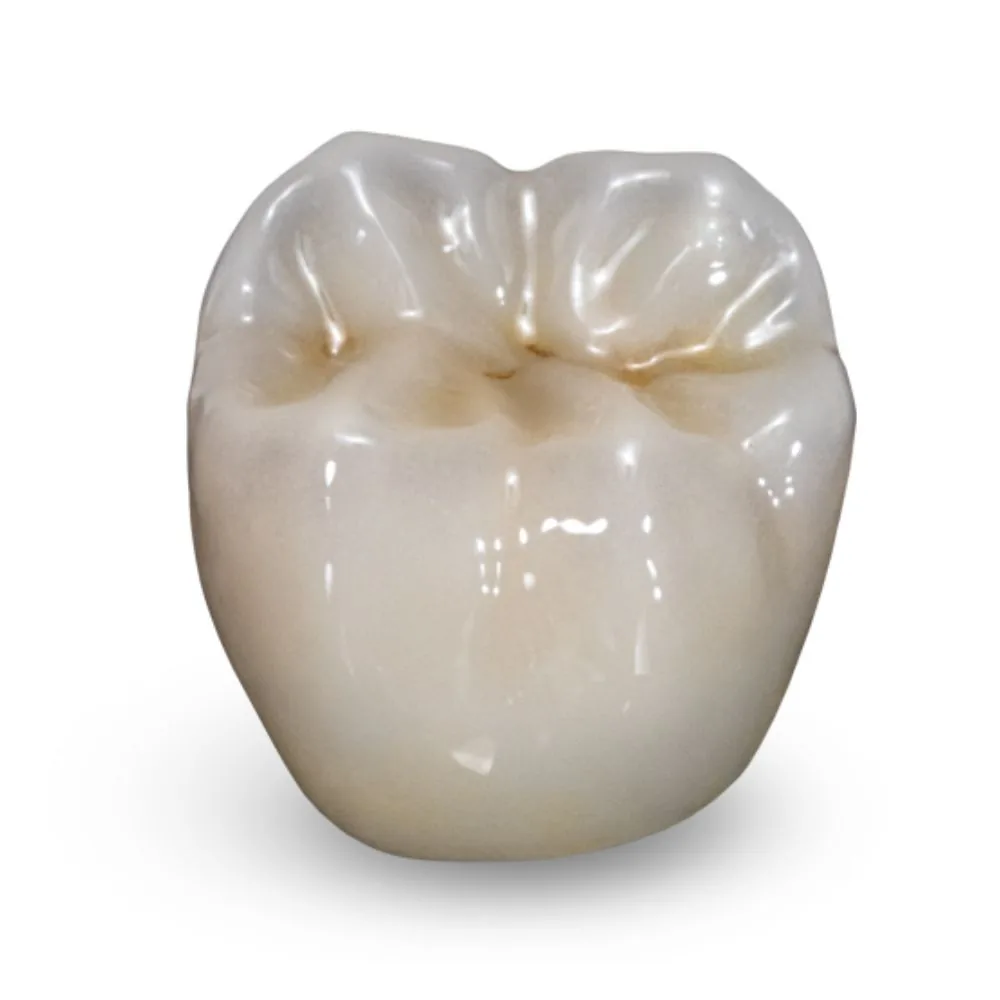 Temporary provisional crown