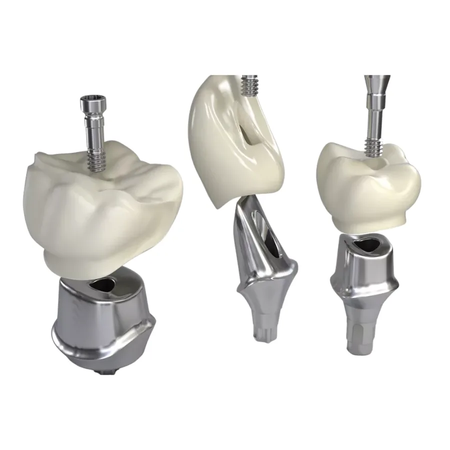 Custom implant abutment design showing emergence profile on screen