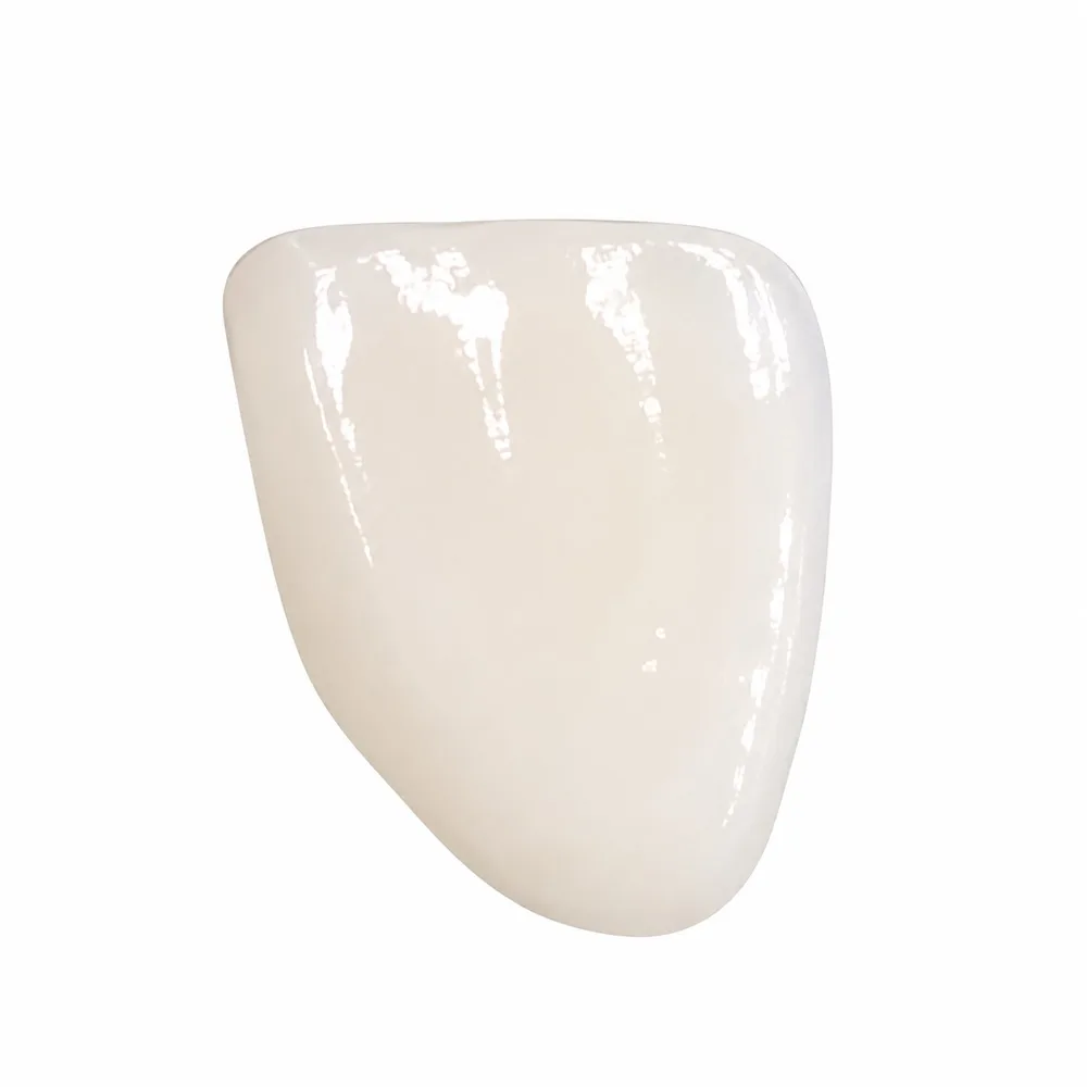 IPS e.max lithium-disilicate veneers